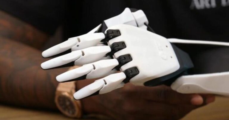 cbsn fusion ai powered prosthetic arm aims to be an accessibility game changer thumbnail 2740726 640x360