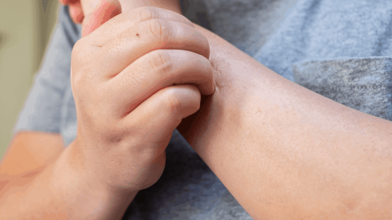 itchy arm
