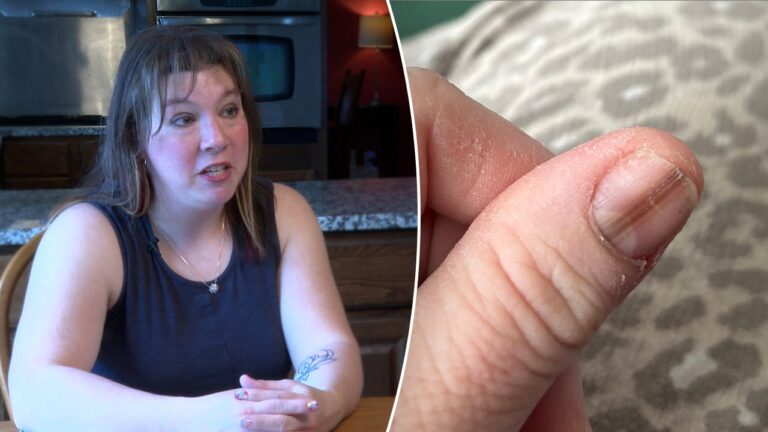 thumb